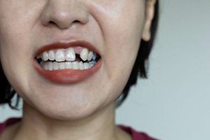 Woman revealing a gap-toothed smile