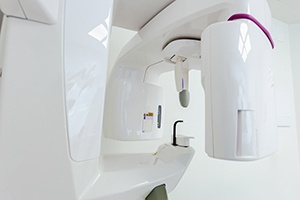 a CBCT scanner inside a dental office  