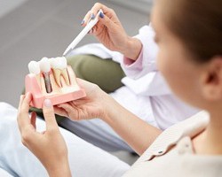Woman learning about dental implants in Carrollton via model