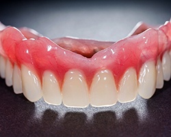 An up-close view of an upper denture that is ready for placement in Carrollton