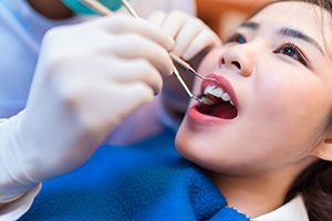 dental checkup in Carrollton 