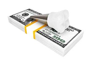 Understanding cost of dental implants in Carrollton