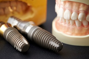 dental implants in Carrollton next to dentures