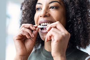 Woman placing clear aligners over upper arch