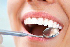 Closeup of patient's teeth during dental exam