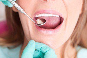 Closeup of patient receiving dental treatment