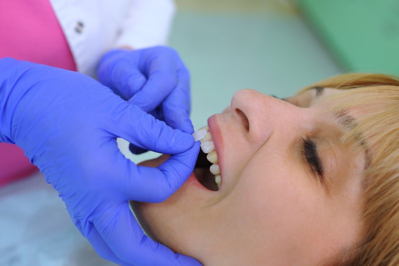 woman undergoing the veneer process in Carrollton